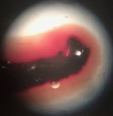 Attēlu rezultāti vaicājumam “Ionomidotis irregularis”