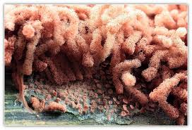 Attēlu rezultāti vaicājumam “Heterotrichia oerstedii (syn. Arcyria oerstedii)”