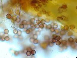 Attēlu rezultāti vaicājumam “Physarum auriscalpium spores”