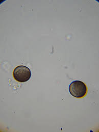 Attēlu rezultāti vaicājumam “Licea testudinacea”