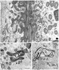 Attēlu rezultāti vaicājumam “Bryum pallens sporophyte”