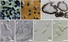 Attēlu rezultāti vaicājumam “Didymium spongiosum var. dictyospora spores”
