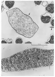 Attēlu rezultāti vaicājumam “Willkommlangea reticulata spores”