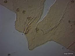 Attēlu rezultāti vaicājumam “Trichia crateriformis”