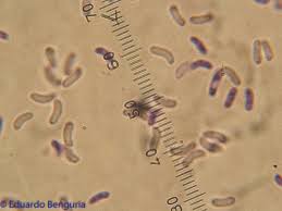 Attēlu rezultāti vaicājumam “Ceriporia viridans”