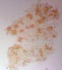 Attēlu rezultāti vaicājumam “Lycogala ustulatum sessile”