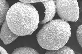 Attēlu rezultāti vaicājumam “Lamproderma pseudomaculatum macro”