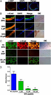 Attēlu rezultāti vaicājumam “Oligonema favogineum plasmodium”
