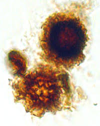 Attēlu rezultāti vaicājumam “Colloderma oculatum spores”