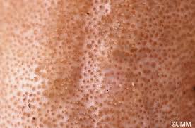 Attēlu rezultāti vaicājumam “Podostroma leucopus”