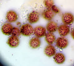 Attēlu rezultāti vaicājumam “Badhamia lilacina var. megaspora”