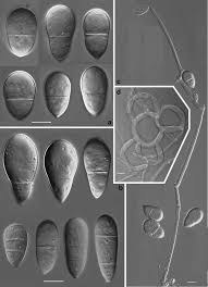 Attēlu rezultāti vaicājumam “Orbilia sp.”