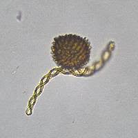 Attēlu rezultāti vaicājumam “Fossombronia wondraczekii”