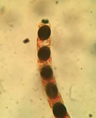 Attēlu rezultāti vaicājumam “Biscogniauxia marginata”