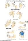 Wrist Excercises - Wrist Rotation, Hand Stretch, CTS Exercises