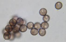 Attēlu rezultāti vaicājumam “Physarum viride var. aurantium spores”
