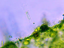 Attēlu rezultāti vaicājumam “Lycogala alisaulianovae sessile”