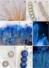 Attēlu rezultāti vaicājumam “Octospora humosa”