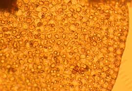 Attēlu rezultāti vaicājumam “Tritomaria exsectiformis cells”