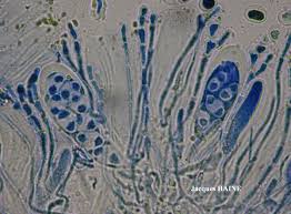 Attēlu rezultāti vaicājumam “Caloplaca scopularis”