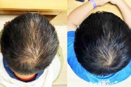 Attēlu rezultāti vaicājumam “Blasia pusilla sporophyte”