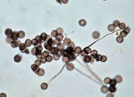 Attēlu rezultāti vaicājumam “Diderma testaceum spores”