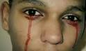 عکس انسان هایی که خون گریه میکنند - niyaz19 - 10-16-2012 05:38 PM - pn54lz7rajep0kb5ehm