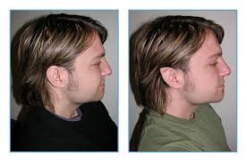 Image result for ear mod