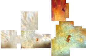 Attēlu rezultāti vaicājumam “Bactridium flavum”