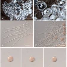 Attēlu rezultāti vaicājumam “Diderma deplanatum sessile”