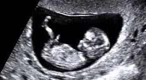 Image result for dating scan means