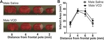 Image result for Vcd Ttc