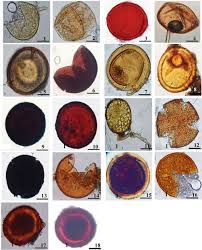 Attēlu rezultāti vaicājumam “Stemonitopsis aequalis var. microspora spores”