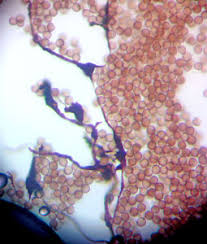 Attēlu rezultāti vaicājumam “Symphytocarpus impexus spores”
