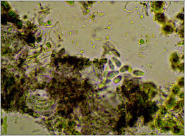 Attēlu rezultāti vaicājumam “Arthonia spadicea”