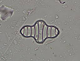 Attēlu rezultāti vaicājumam “Diderma radiatum young”
