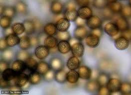 Attēlu rezultāti vaicājumam “Trichia contorta spores”