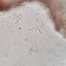 Attēlu rezultāti vaicājumam “Licea castanea spores”