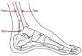 Ankle Fractures - OrthoInfo - AAOS