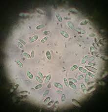 Attēlu rezultāti vaicājumam “Ionomidotis irregularis”