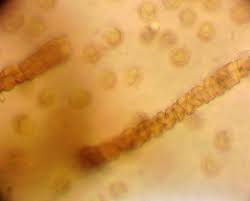 Attēlu rezultāti vaicājumam “Lycogala ustulatum sessile”