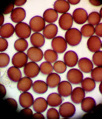 Attēlu rezultāti vaicājumam “Fuligo laevis”