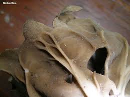 Attēlu rezultāti vaicājumam “Helvella acetabulum”