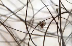 Image result for schamhaar