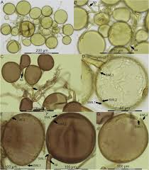 Attēlu rezultāti vaicājumam “Enteridium variabile spores”
