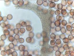 Attēlu rezultāti vaicājumam “Badhamia capsulifera var. arborea sessile”
