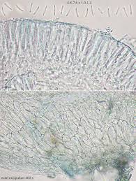 Attēlu rezultāti vaicājumam “Hyalorbilia inflatula”