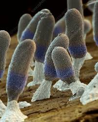 Attēlu rezultāti vaicājumam “Diachea leucopodia spores”