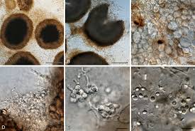 Attēlu rezultāti vaicājumam “Penicillium vulpinum”