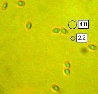 Attēlu rezultāti vaicājumam “Postia stiptica”